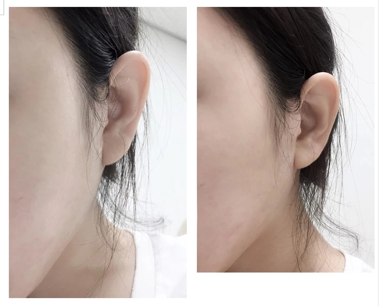 假脸皮贴贴化妆用 超薄贴 小脸贴 隐型贴女 隐型