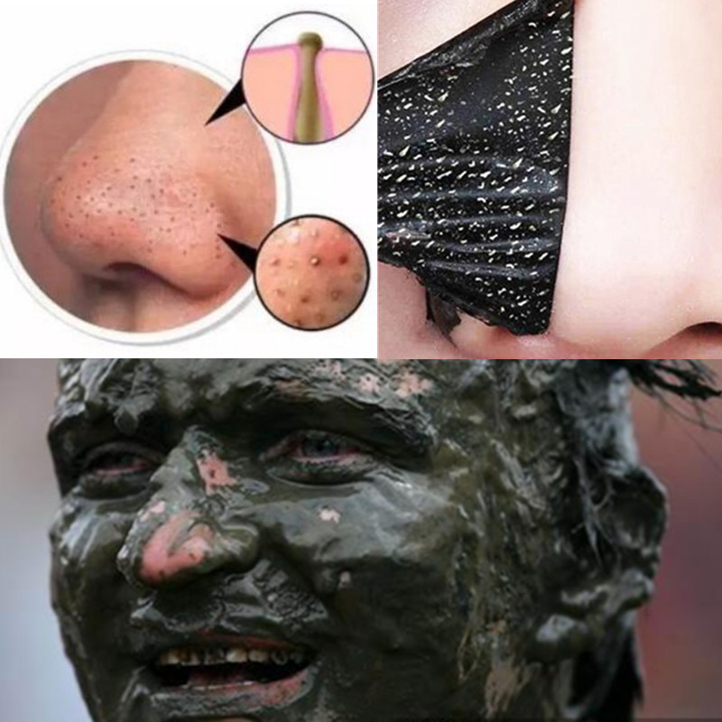 【2018抖音同款告别脏脸】别让脏脸影响你的美 去脏脸神器 撕拉式