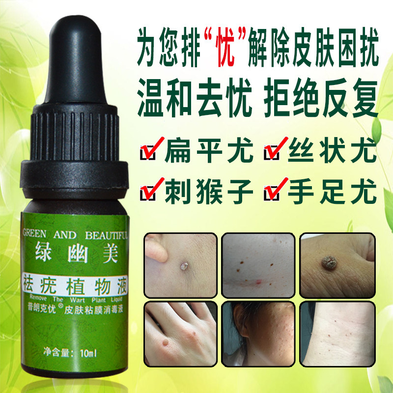 去扁平疣特效 面部_特效去除面部扁平疣去疣灵脖子颈部丝状疣跖疣必治