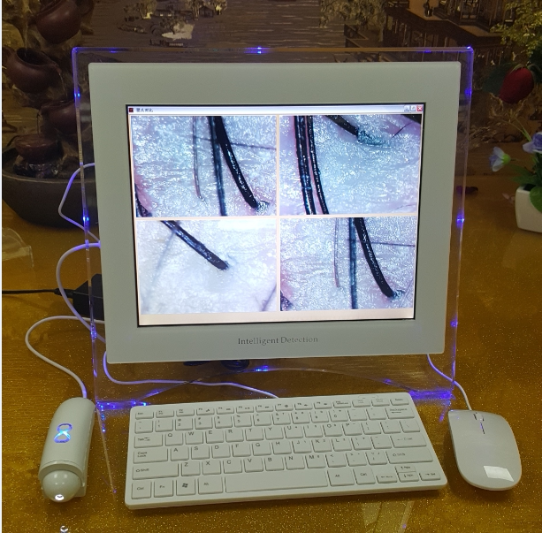 新款智能头发检测仪头皮分析仪脱发测试仪毛发白发角质高清一体机