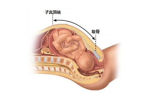 无聊时可测量宫高看胎儿发育情况,打发时间