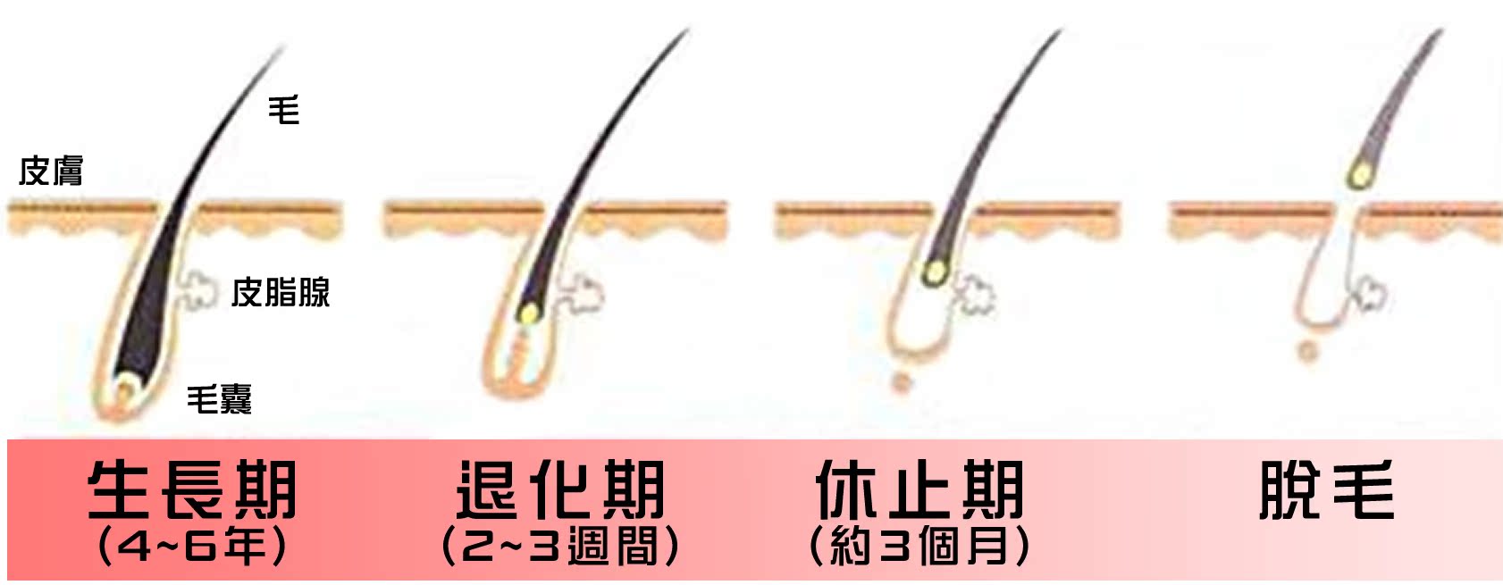 脱毛:如果可以永远变光滑,为什么说不?