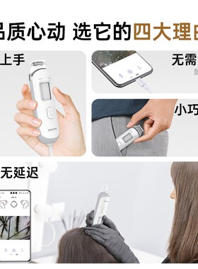 mriya头发头皮毛囊检测仪超细腻观感有线手持便捷多功能毛囊镜