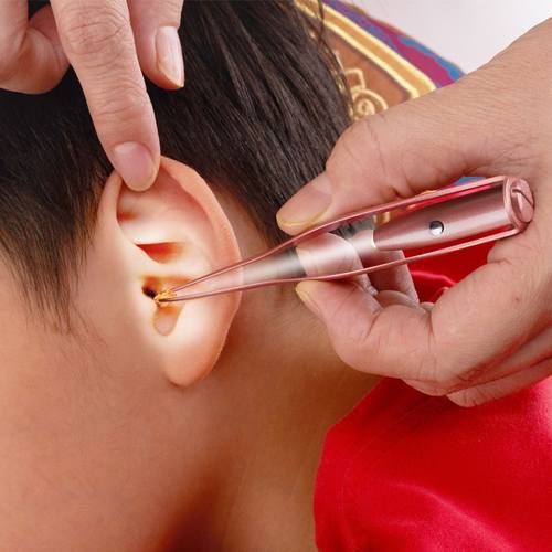 厂家现货儿童可视发光挖耳勺耳3掏耳朵鼻屎工具耳屎件采套装镊子 - 图1