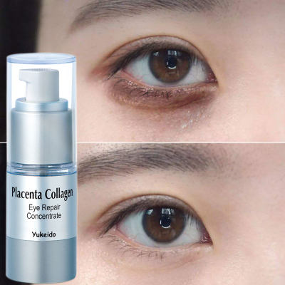 日本yukeido眼霜抗初老淡化黑眼圈眼袋细纹脂肪粒去除神器男女士 虎窝淘