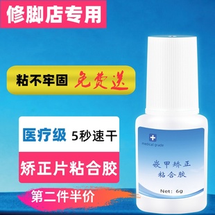 正甲贴拉拉贴德国BS进口弹片胶水甲沟嵌齐甲炎矫正器贴片专用胶水