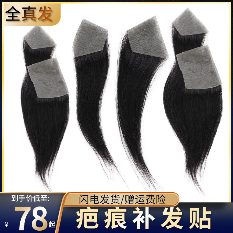 假发贴片无痕隐形疤痕贴真人发丝假发男女生态膜斑秃小面积补发片
