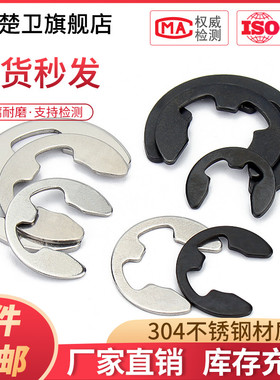 65锰卡簧挡圈卡环e型304不锈钢开口卡扣M1.5M2.5M3M4M5M6M8M10M15