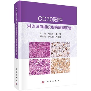 【2022新版】CD30阳性淋巴造血组织疾病病理图谱 刘卫平王哲主编恶性肿瘤血液肿瘤临床诊治肿瘤学淋巴组织肿瘤淋巴组织增生性疾病