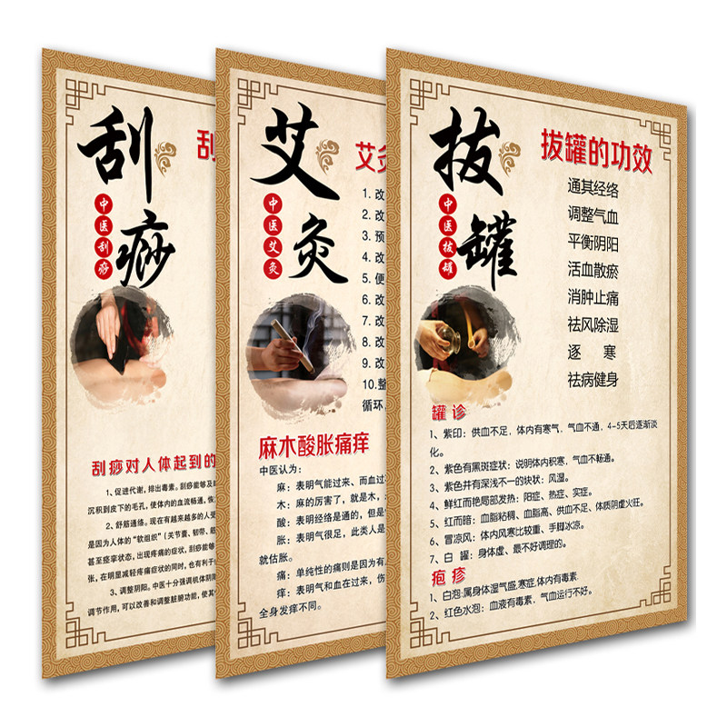 拔罐的功效经络艾灸刮痧人体穴位图挂图中医养生馆装饰宣传画海报
