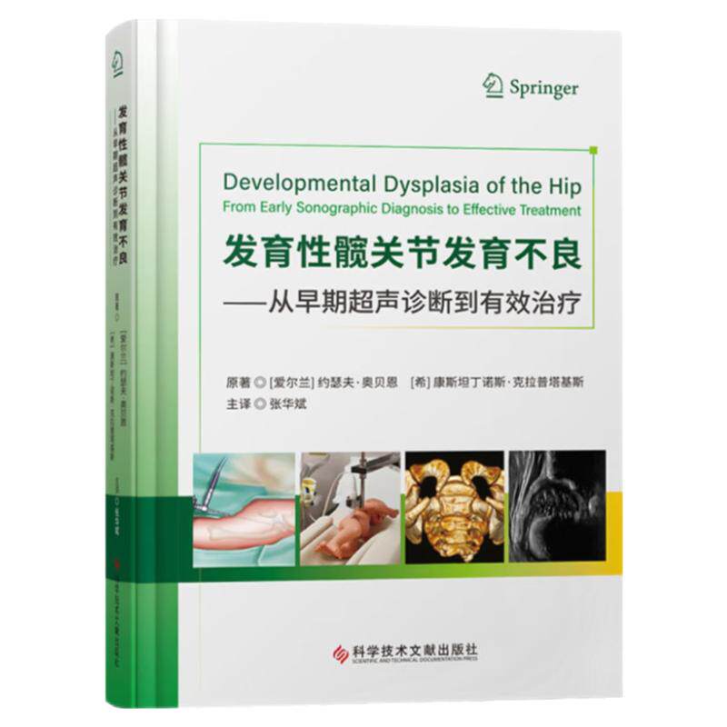 团购发育性髋关节发育