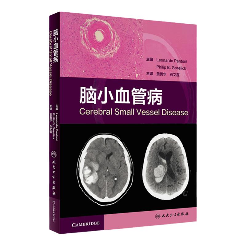 脑小血管病 脑小血管疾病是脑血管疾病的分支学科 临床脑小血管病的分类病理神经影像学治疗 脑血管造影预防心脑血管 心脑血管书籍