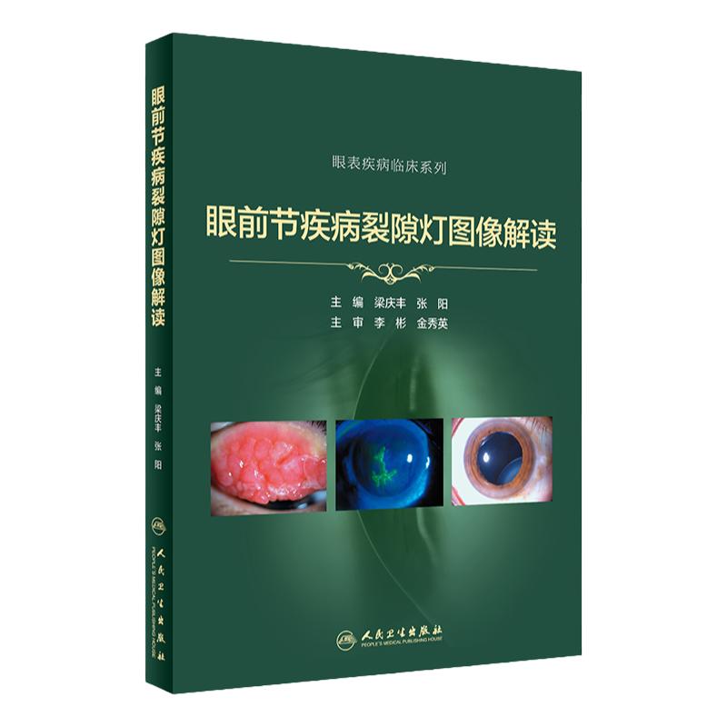 眼前节疾病裂隙灯图像解读