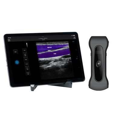 全科无线超声彩超仪器兽用多合一