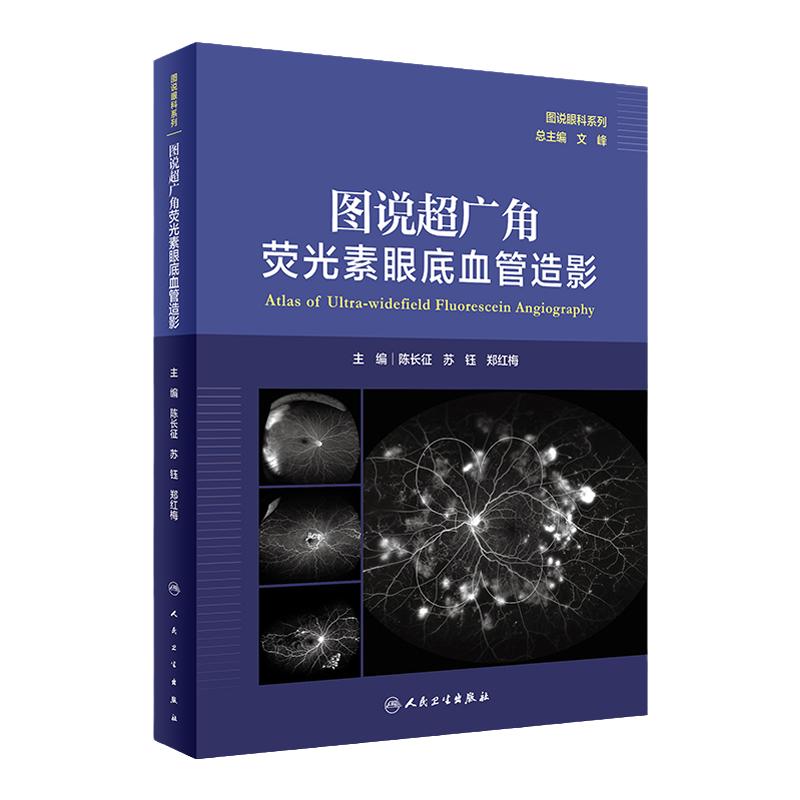 正版 图说超广角荧光素眼底血管造影图说眼科系列陈长征苏钰郑红梅主编超广角眼底自发荧光 人民卫生出版社9787117314510