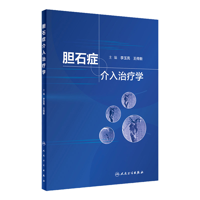 胆石症介入治疗学 李玉亮主编 经皮穿肝十二指肠乳头肌扩张术治疗胆总管结石 介入科影像科消化内科普外科核心能力提升引导丛书