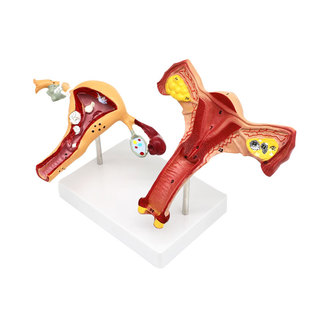 人体女性生殖子宫解剖病理模型 阴道卵巢教学模型 妇科生殖科教具