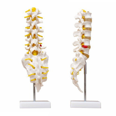 颈椎带颈动脉,后枕骨,椎间盘与神经模型,颈椎关节模型 脊柱模具