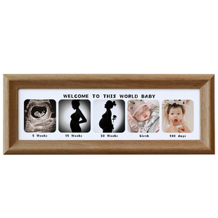 宝宝一周岁纪念相框摆台儿童成长记录相册洗照片做成周年纪念挂墙