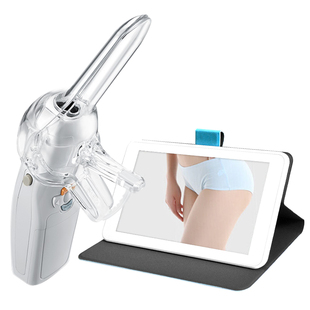 星天使妇科视检镜高清阴道镜宫颈检查仪自检镜私密检测仪器内窥镜