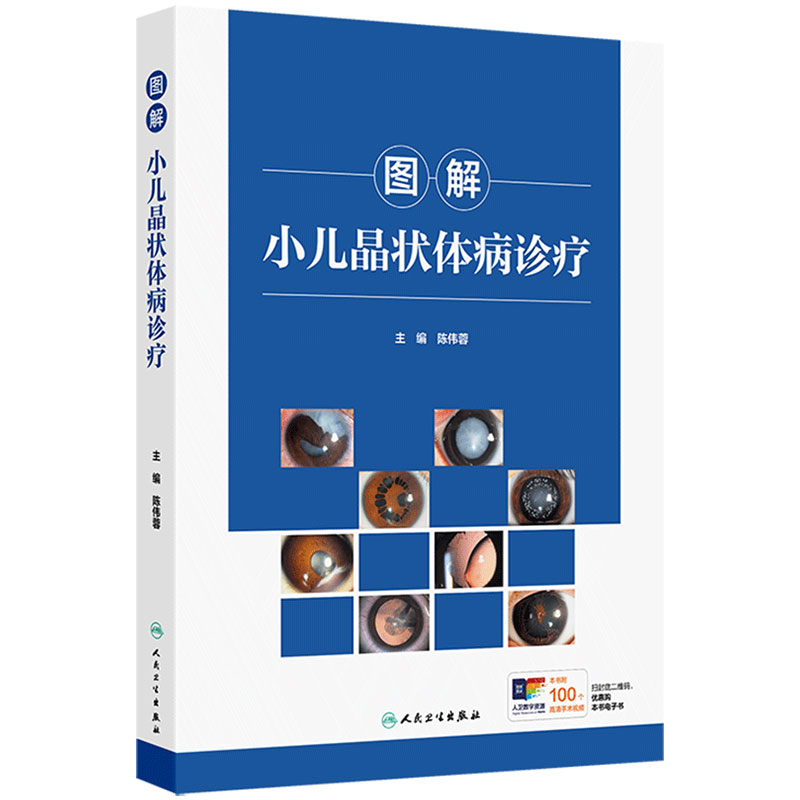 图解小儿晶状体病诊疗 陈伟蓉先天性白内障专科检查手术麻醉诊断裂隙灯眼部图像视觉康复人民卫生出版社儿童眼科学