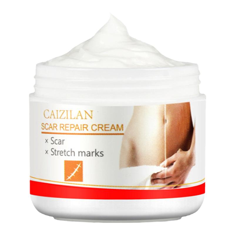 Scar Repair Cream Acne Scars Remove Pregnant Women Skin Care
