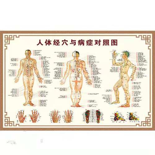 人体经络穴位图标准大图中医养生理疗馆人体病症穴位图解挂图高清