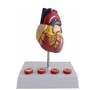 康泰模型人体心脏血管狭窄心房室病理医药促销肥大二尖瓣主动脉瓣