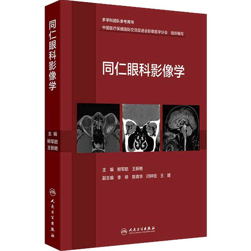 同仁眼科影像学 鲜军舫,王新艳 眼科疾病影像诊断学 基于解剖部位的眼部影像诊断与鉴别诊断 人民卫生出版社 9787117379977