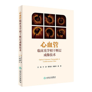 旗舰店现货人卫心血管