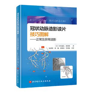 正版 冠状动脉造影读片技巧图解正常及异常造影 中川义久 林秀隆 从冠脉造影小白快速进阶PCI达人视频版 北京科学技术出版