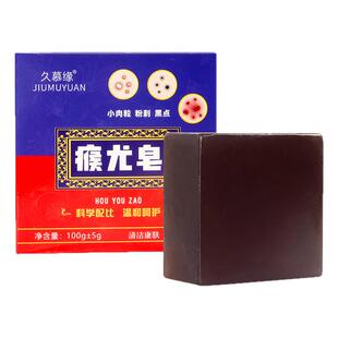 肤康皂去尤瘊疣脖子上长小肉粒疙瘩克除丝状草本专用手工香皂非药