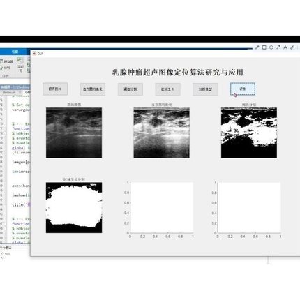 Python代编深度机器学习接单matlab代码编程数据分析预测图像处理