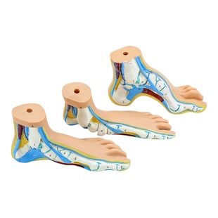 教学人体足部肌肉解剖模型 正常足扁平足弓型足 高弓足部病理模型