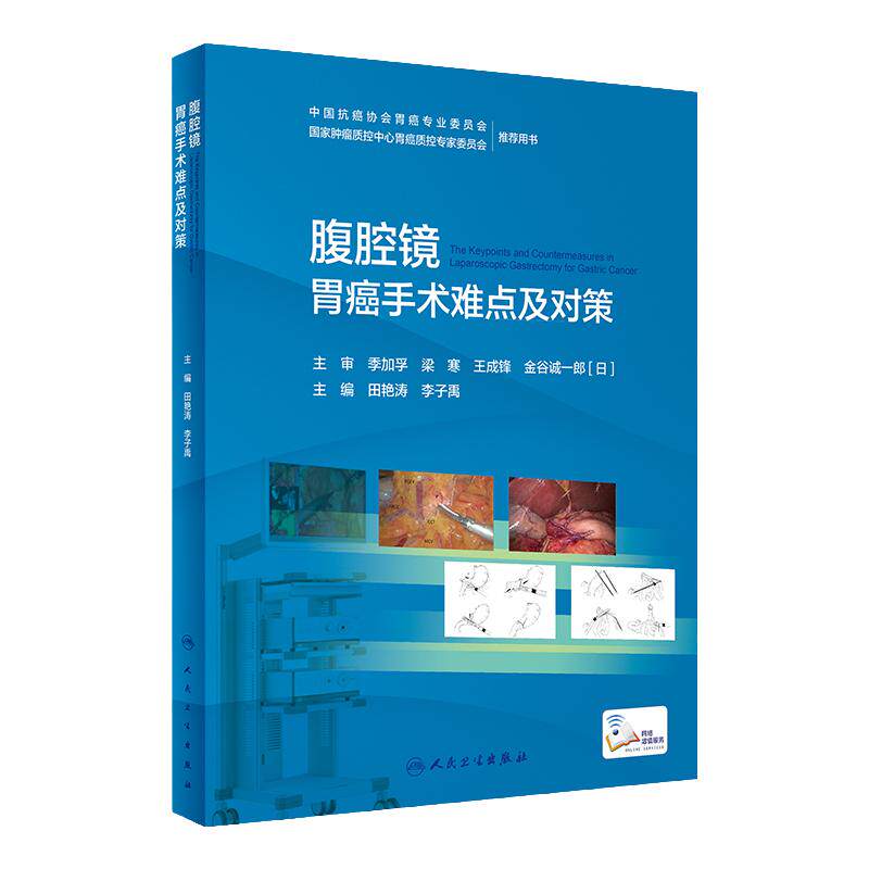 腹腔镜胃癌手术难点及对策