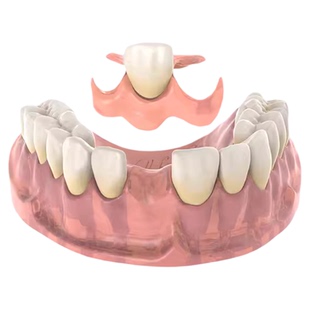 活动隐形义齿定制假牙临时门牙遮丑树脂全口牙可吃饭医院同款义牙