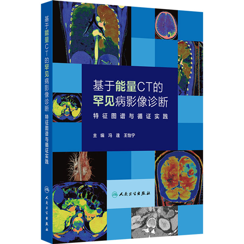 基于能量CT的罕见病影像诊断—特征图谱与循证实践 冯逢王怡宁 本书是国内首部系统介绍罕见病CT能量成像诊断的专著人民卫生出版社