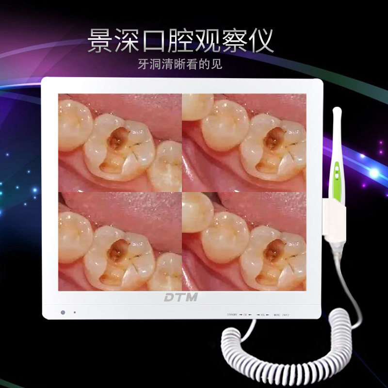 口腔观察仪 高清摄像拍照检查牙齿工具17寸WIFI牙科内窥镜一体机