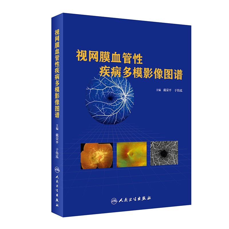 视网膜血管性疾病多模影像图谱 眼科学 眼科学基础 医学书籍影像医学 戴荣平 于伟泓主编 视网膜疾病 正常眼底检查 人民卫生出版社