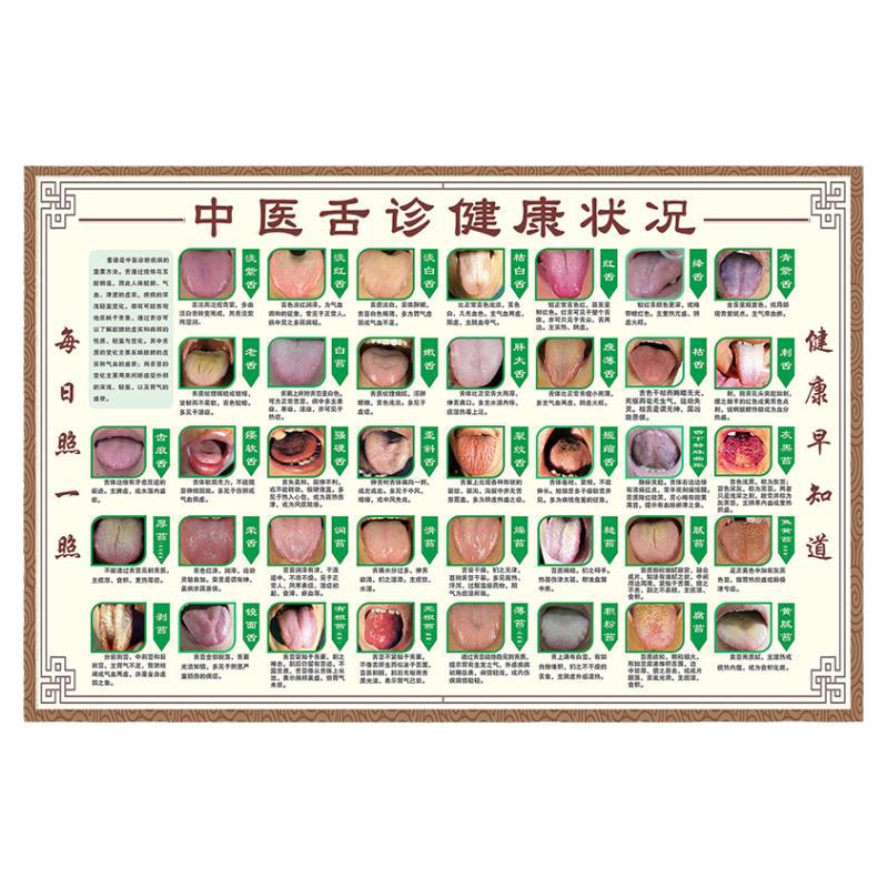 健康状况对照表经络舌苔问题海报