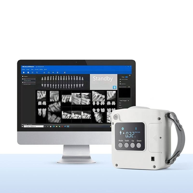 牙科X光机 蓝野射线机拍片机传感器 Runyes移动式高频 X光射线机