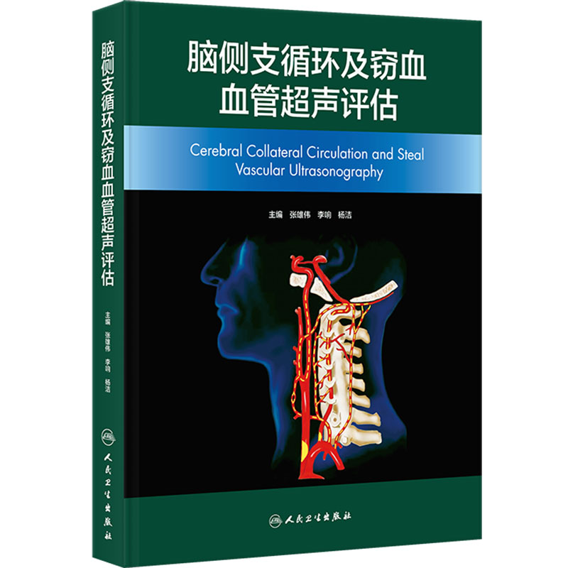 脑侧支循环及窃血血管超声评估 张宏伟杨洁李娟 临床脑卒中急诊内科外科神经介入急危重症人民卫生出版社影像医学神经病学