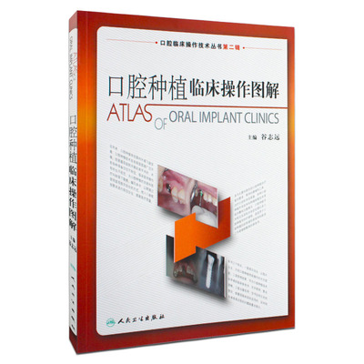 口腔种植临床操作图解 口腔临床操作技术丛书 谷志远主编 人民卫生出版社9787117129831