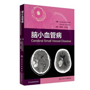脑小血管病 黄勇华石文磊主译内科学实用手册病理脑血管病9787117269964人民卫生出版社脑卒中神经影像学临床参考书脑小血管病学