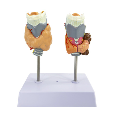 蓝蝶模型甲状腺喉头病变教具