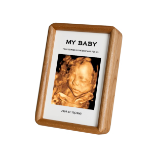 四维照片相框孕期胎儿nt B超彩超打印婴儿宝宝出生新生纪念照摆台