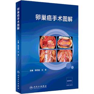卵巢癌手术图解 韩世超 王军 主编 卵巢癌手术相关解剖 全面分期手术 肿瘤细胞减灭术等 人民卫生出版社 9787117359573