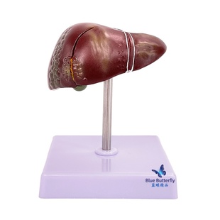 教学仿真人体肝脏解剖模型肝解剖肝胆胰脾十二指肠浮雕病变肝胆胰