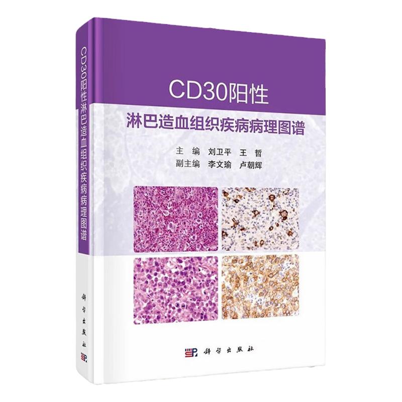 CD30阳性淋巴造血组织疾病病理图谱 外科学 收集62例表达CD30的淋巴组织肿瘤和淋巴组织增生性疾病病例 病例内容翔实 科学出版社