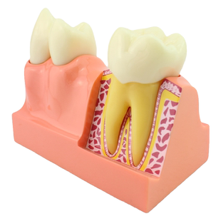 ENOVO颐诺牙体分解模型牙齿解剖模型 口腔科教学牙体解剖形态模型口腔解剖生理学牙髓腔牙冠部髓室Crown牙体